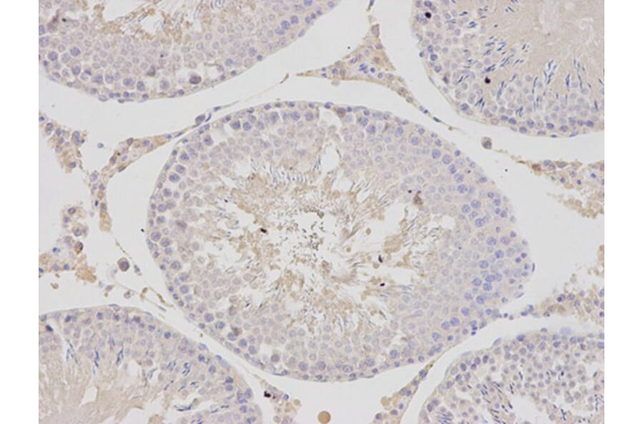 Immunohistochemistry - PSMC4 Antibody from Signalway Antibody (32681) - Antibodies.com