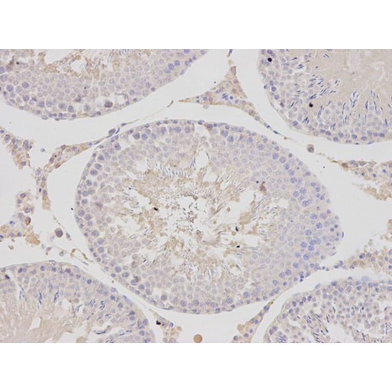 Immunohistochemistry - PSMC4 Antibody from Signalway Antibody (32681) - Antibodies.com