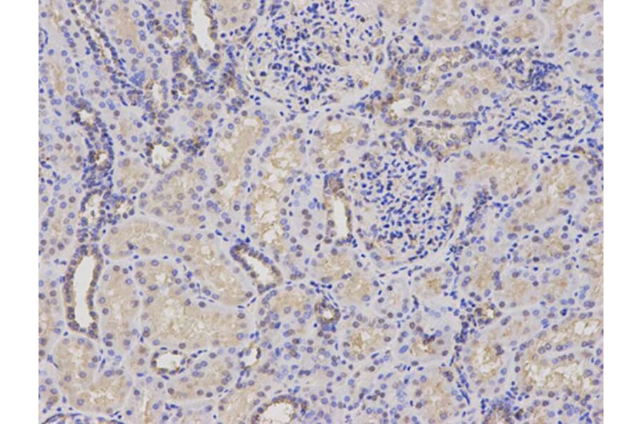 Immunohistochemistry - PSMC4 Antibody from Signalway Antibody (32681) - Antibodies.com