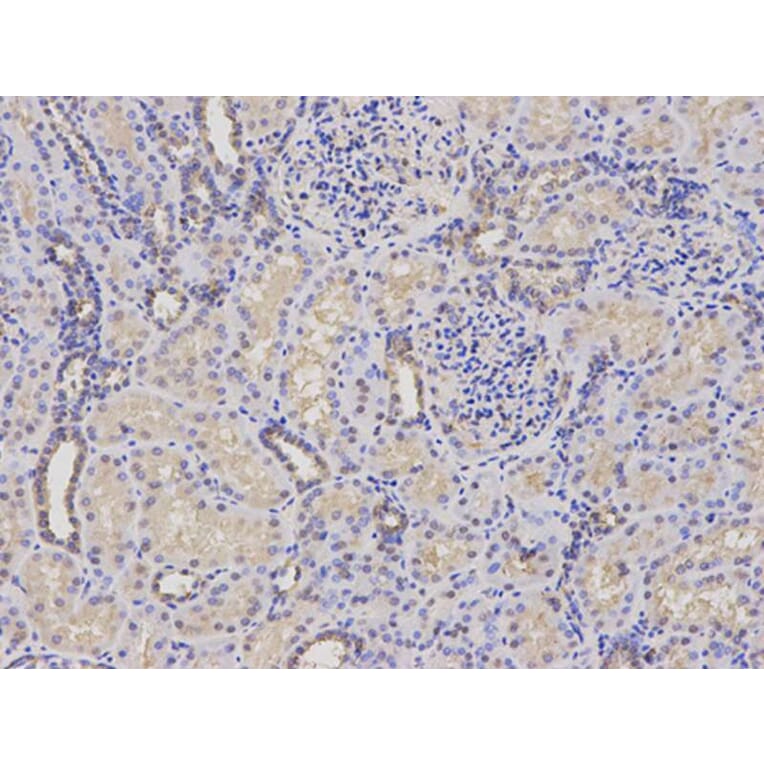 Immunohistochemistry - PSMC4 Antibody from Signalway Antibody (32681) - Antibodies.com