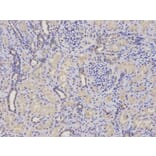 Immunohistochemistry - PSMC4 Antibody from Signalway Antibody (32681) - Antibodies.com