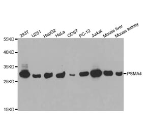Western blot - PSMA4 Antibody from Signalway Antibody (32683) - Antibodies.com