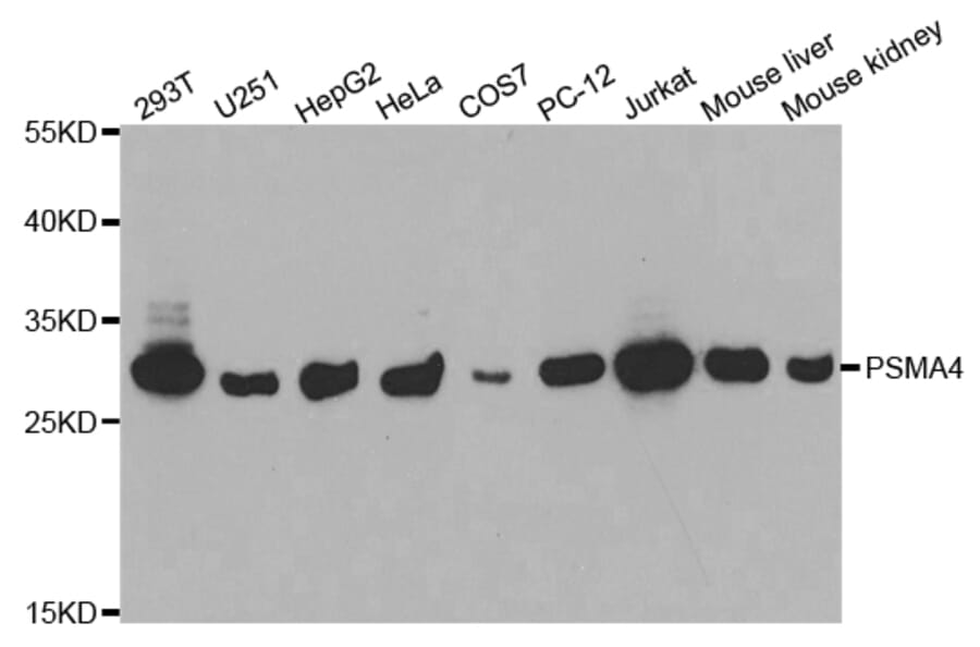 Western blot - PSMA4 Antibody from Signalway Antibody (32683) - Antibodies.com