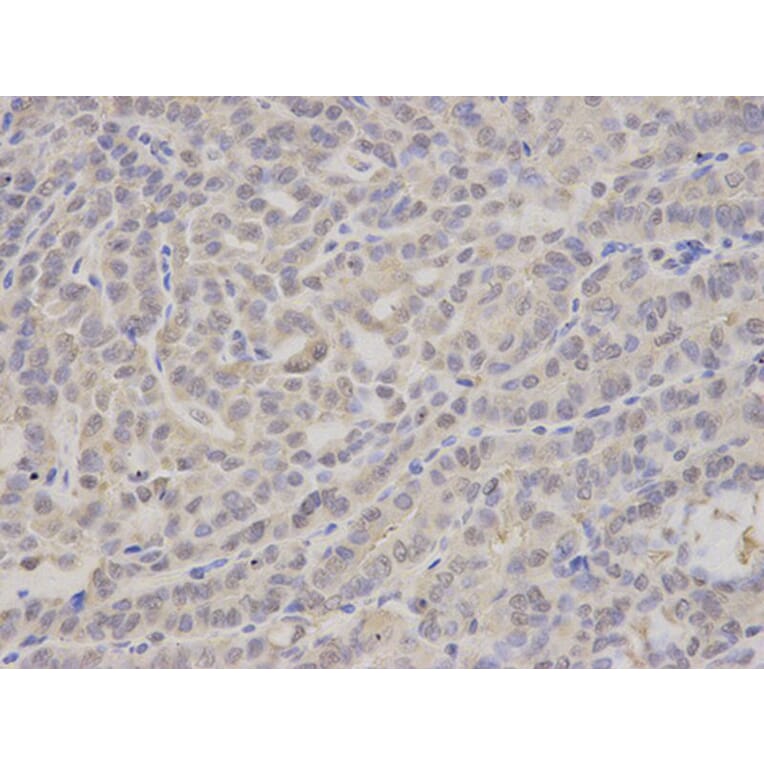Immunohistochemistry - PSMA4 Antibody from Signalway Antibody (32683) - Antibodies.com
