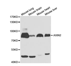 Western blot - AXIN2 Antibody from Signalway Antibody (32685) - Antibodies.com