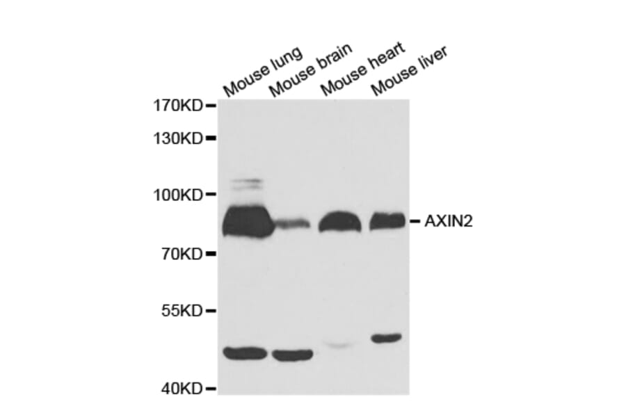 Western blot - AXIN2 Antibody from Signalway Antibody (32685) - Antibodies.com