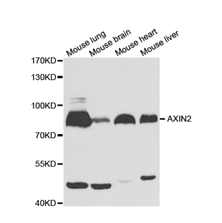 Western blot - AXIN2 Antibody from Signalway Antibody (32685) - Antibodies.com