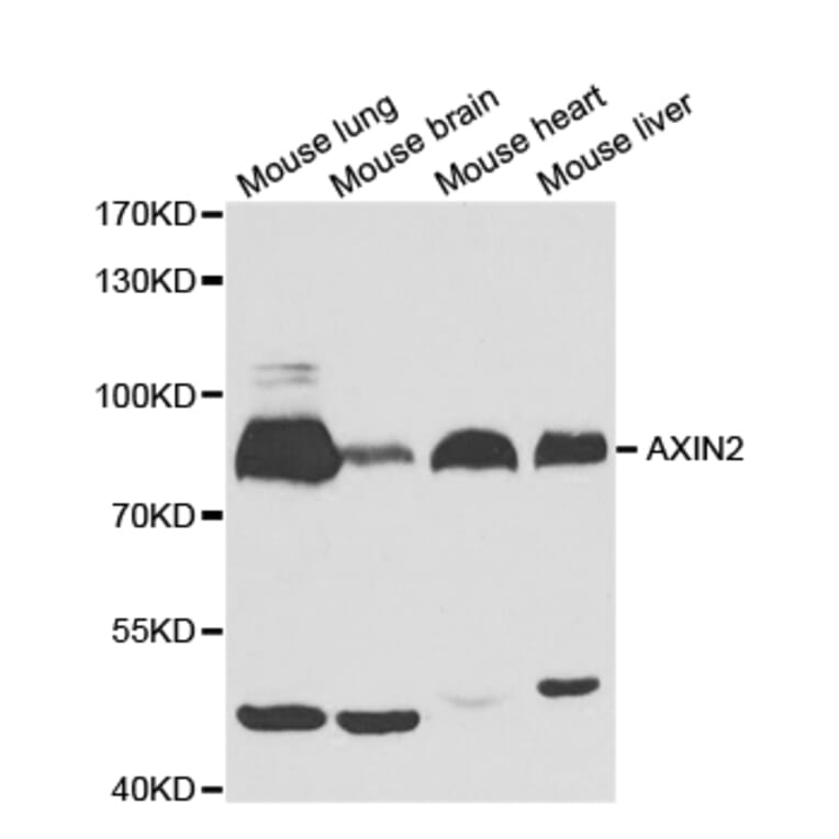 Western blot - AXIN2 Antibody from Signalway Antibody (32685) - Antibodies.com