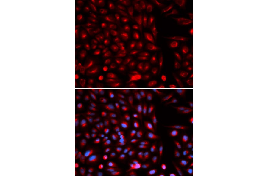 Immunofluorescence - AXIN2 Antibody from Signalway Antibody (32685) - Antibodies.com