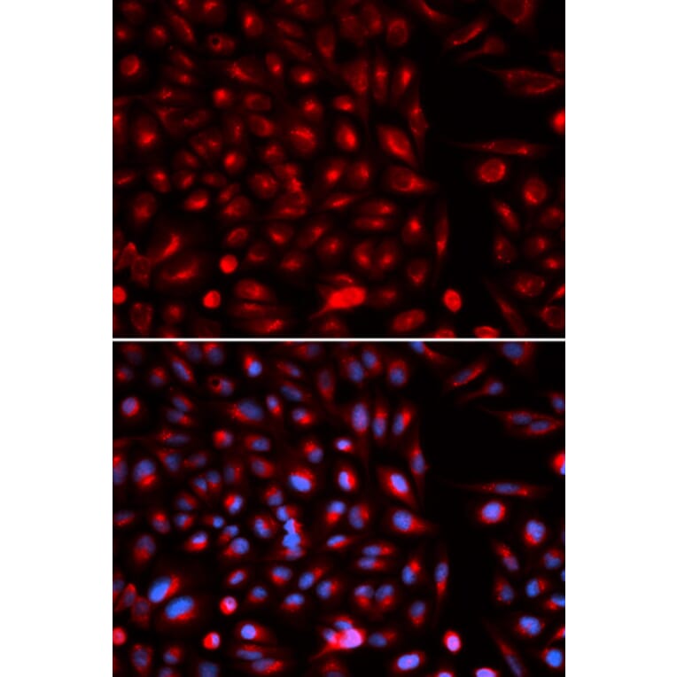 Immunofluorescence - AXIN2 Antibody from Signalway Antibody (32685) - Antibodies.com
