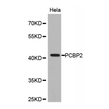 Western blot - PCBP2 Antibody from Signalway Antibody (32696) - Antibodies.com