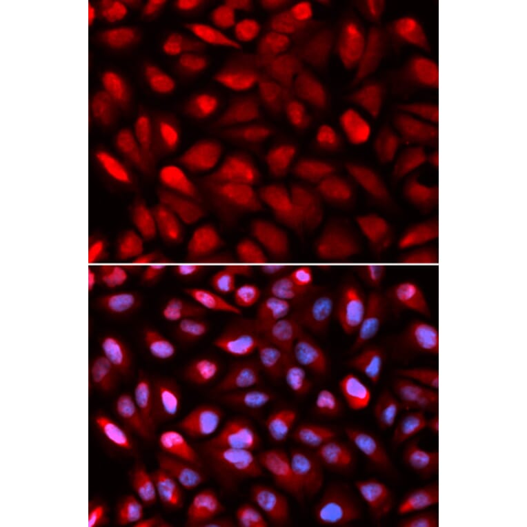 Immunofluorescence - PCBP2 Antibody from Signalway Antibody (32696) - Antibodies.com