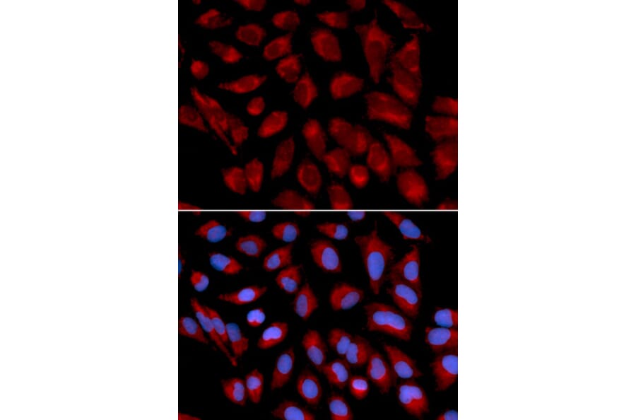 Immunofluorescence - AIFM1 Antibody from Signalway Antibody (32720) - Antibodies.com