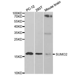 Western blot - SUMO2 Antibody from Signalway Antibody (32722) - Antibodies.com