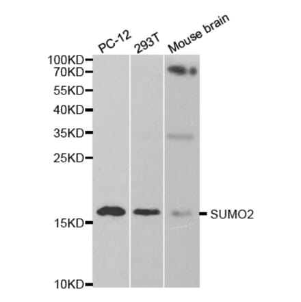 Western blot - SUMO2 Antibody from Signalway Antibody (32722) - Antibodies.com