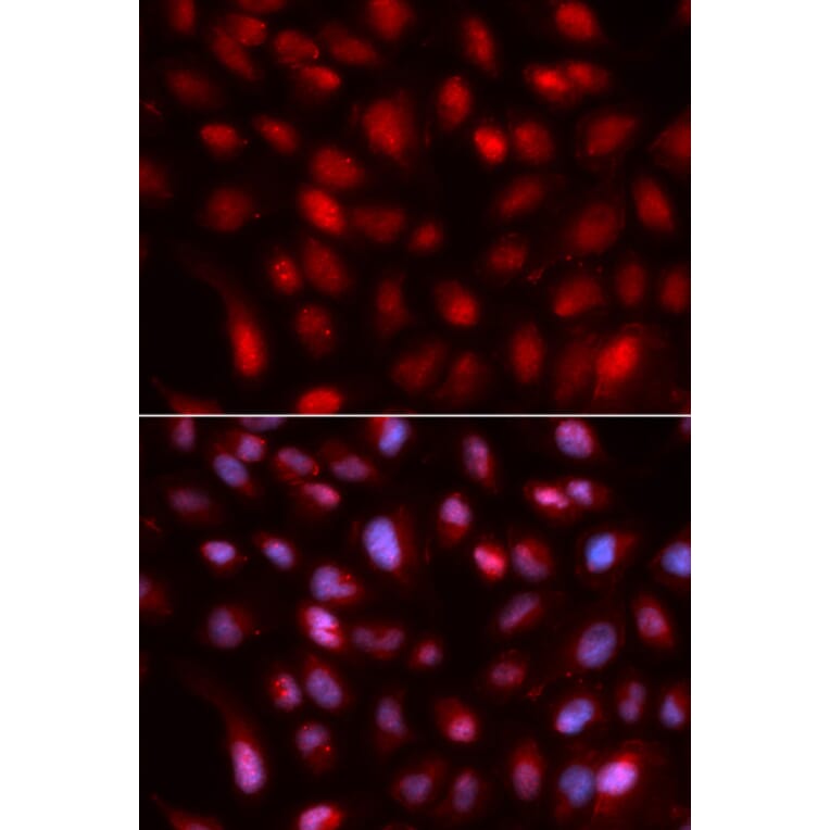Immunofluorescence - SUMO2 Antibody from Signalway Antibody (32722) - Antibodies.com