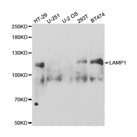 Western blot - LAMP1 Antibody from Signalway Antibody (32731) - Antibodies.com