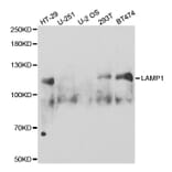 Western blot - LAMP1 Antibody from Signalway Antibody (32731) - Antibodies.com