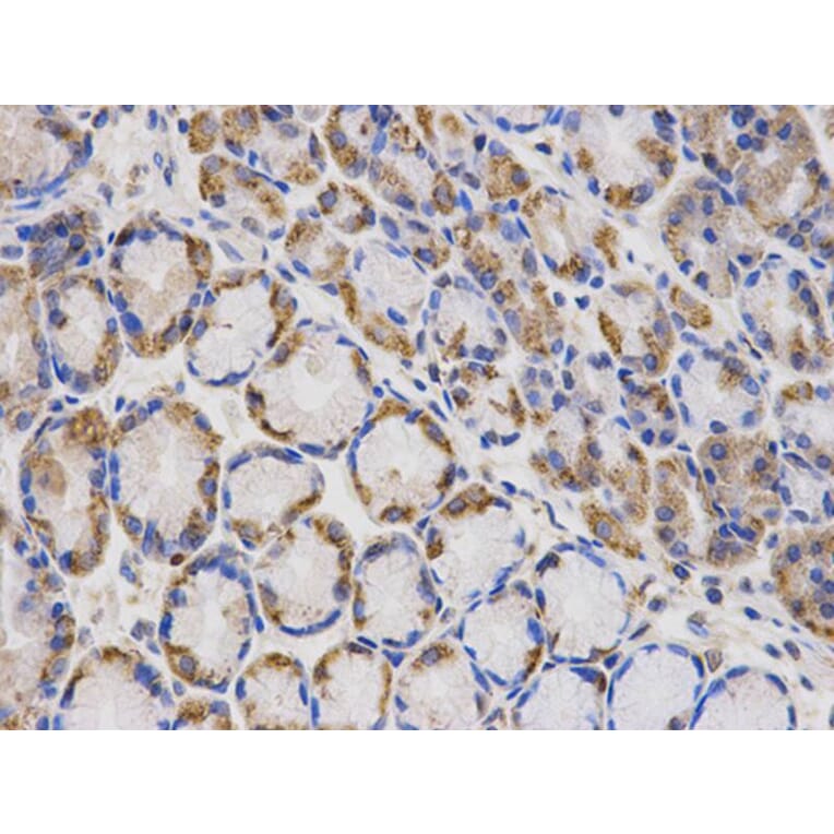 Immunohistochemistry - LAMP1 Antibody from Signalway Antibody (32731) - Antibodies.com