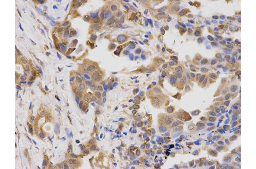 Immunohistochemistry - LAMP1 Antibody from Signalway Antibody (32731) - Antibodies.com