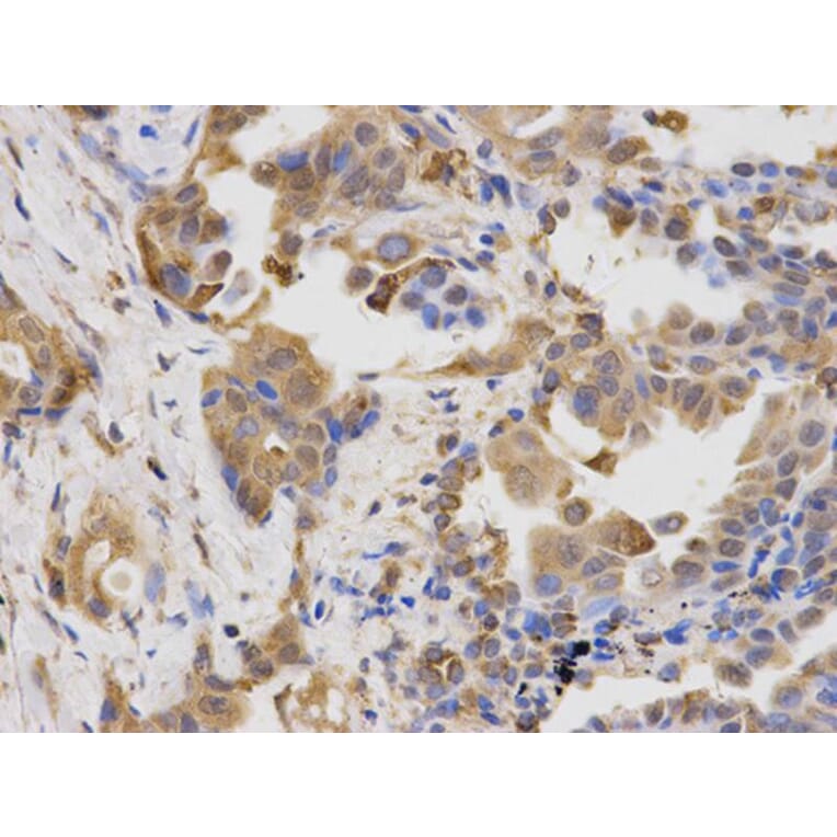 Immunohistochemistry - LAMP1 Antibody from Signalway Antibody (32731) - Antibodies.com