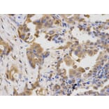 Immunohistochemistry - LAMP1 Antibody from Signalway Antibody (32731) - Antibodies.com