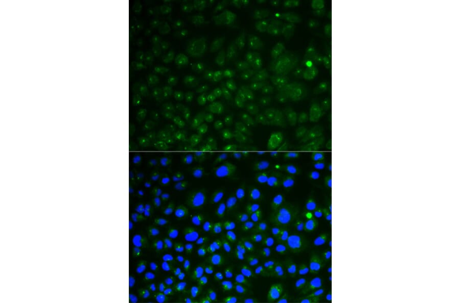 Immunofluorescence - LAMP1 Antibody from Signalway Antibody (32731) - Antibodies.com
