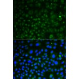 Immunofluorescence - LAMP1 Antibody from Signalway Antibody (32731) - Antibodies.com