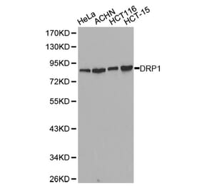 Western blot - DNM1L Antibody from Signalway Antibody (32735) - Antibodies.com