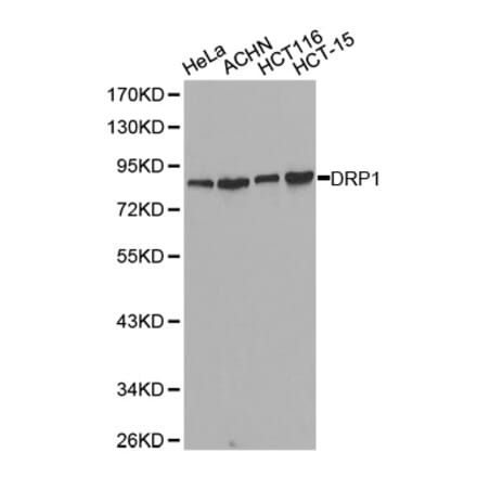 Western blot - DNM1L Antibody from Signalway Antibody (32735) - Antibodies.com