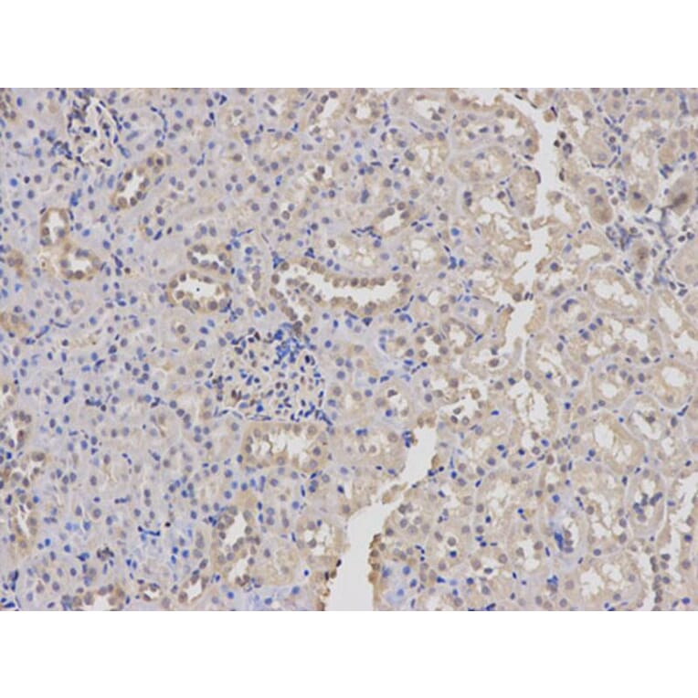Immunohistochemistry - DNM1L Antibody from Signalway Antibody (32735) - Antibodies.com