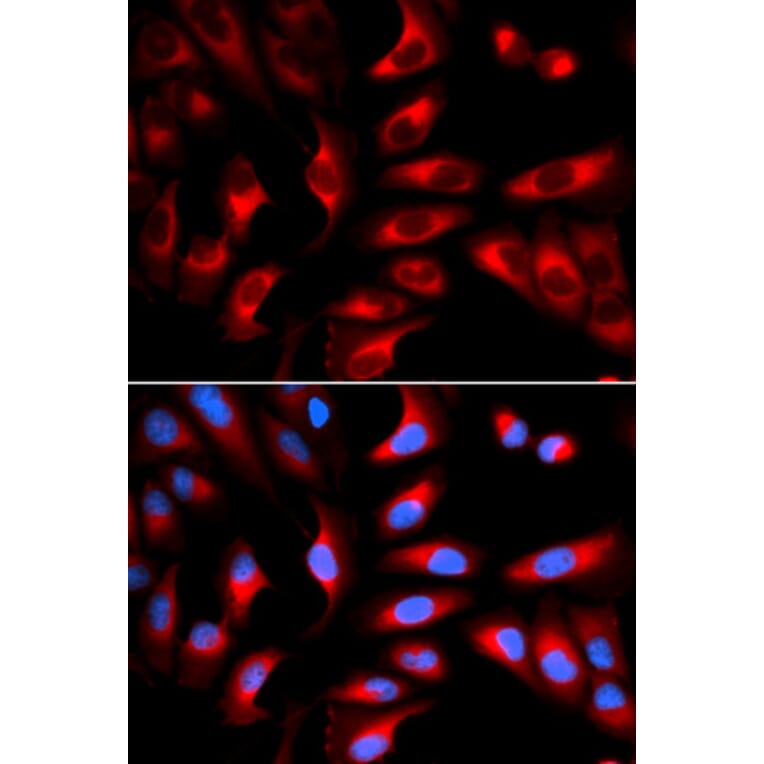 Immunofluorescence - DNM1L Antibody from Signalway Antibody (32735) - Antibodies.com
