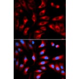 Immunofluorescence - DNM1L Antibody from Signalway Antibody (32735) - Antibodies.com