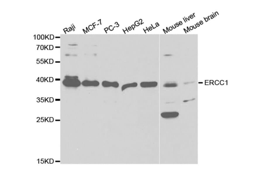 Western blot - ERCC1 Antibody from Signalway Antibody (32747) - Antibodies.com