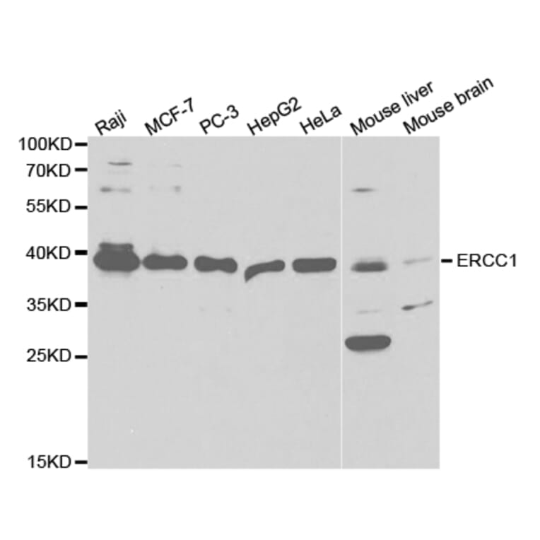 Western blot - ERCC1 Antibody from Signalway Antibody (32747) - Antibodies.com