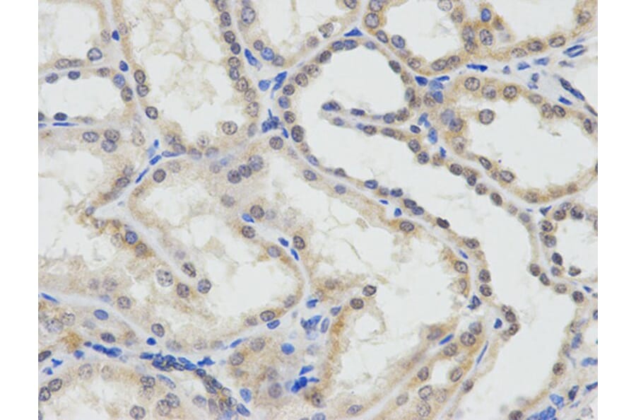 Immunohistochemistry - ERCC1 Antibody from Signalway Antibody (32747) - Antibodies.com
