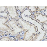 Immunohistochemistry - ERCC1 Antibody from Signalway Antibody (32747) - Antibodies.com