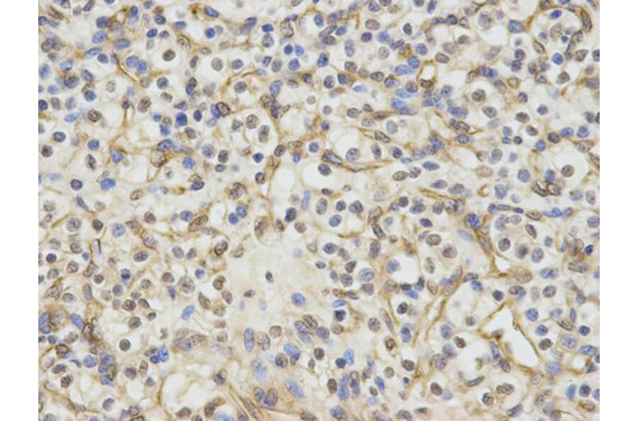 Immunohistochemistry - ERCC1 Antibody from Signalway Antibody (32747) - Antibodies.com
