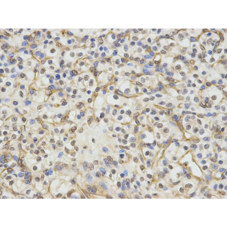 Immunohistochemistry - ERCC1 Antibody from Signalway Antibody (32747) - Antibodies.com