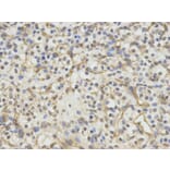 Immunohistochemistry - ERCC1 Antibody from Signalway Antibody (32747) - Antibodies.com