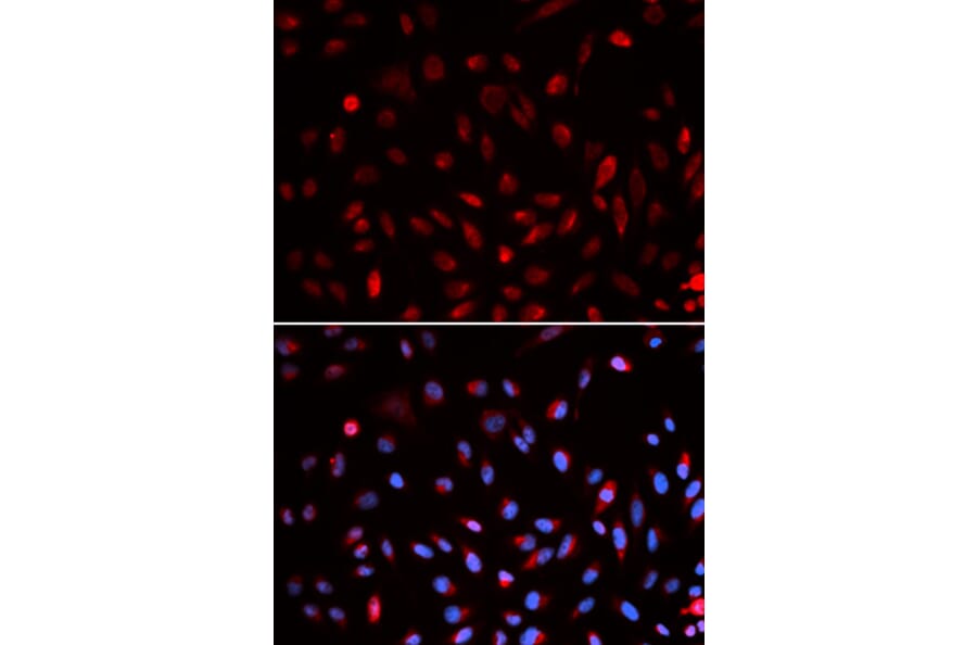Immunofluorescence - ERCC1 Antibody from Signalway Antibody (32747) - Antibodies.com