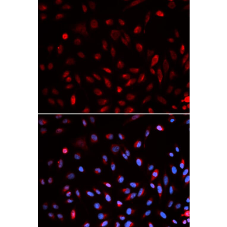 Immunofluorescence - ERCC1 Antibody from Signalway Antibody (32747) - Antibodies.com
