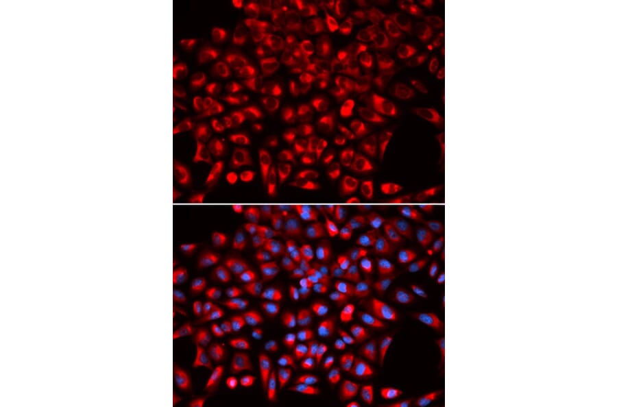 Immunofluorescence - AIMP1 Antibody from Signalway Antibody (32755) - Antibodies.com