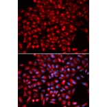 Immunofluorescence - AIMP1 Antibody from Signalway Antibody (32755) - Antibodies.com