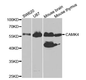 Western blot - CAMK4 Antibody from Signalway Antibody (32758) - Antibodies.com