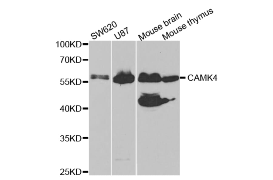Western blot - CAMK4 Antibody from Signalway Antibody (32758) - Antibodies.com