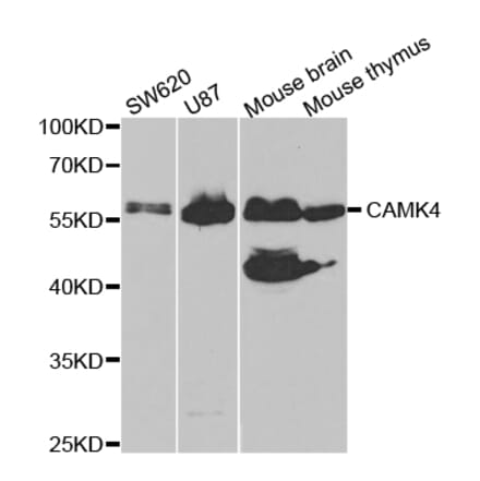 Western blot - CAMK4 Antibody from Signalway Antibody (32758) - Antibodies.com