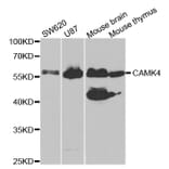 Western blot - CAMK4 Antibody from Signalway Antibody (32758) - Antibodies.com