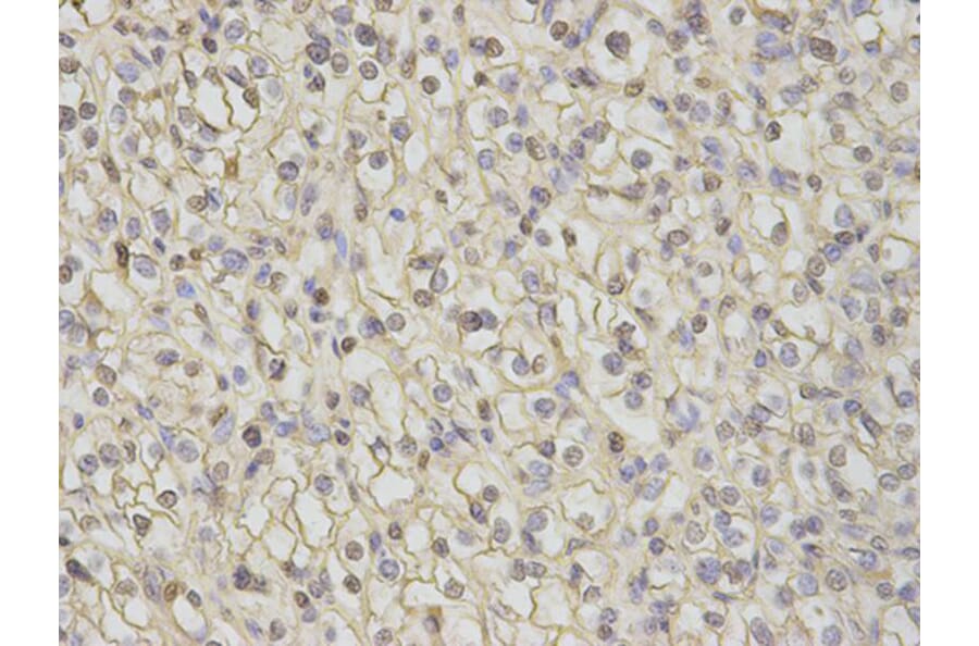 Immunohistochemistry - CAMK4 Antibody from Signalway Antibody (32758) - Antibodies.com