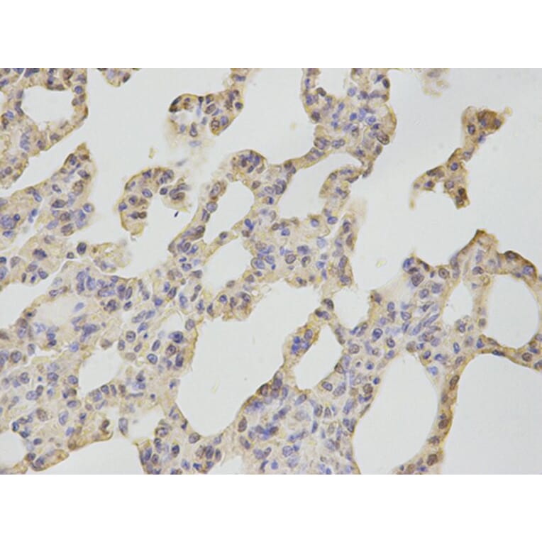 Immunohistochemistry - CAMK4 Antibody from Signalway Antibody (32758) - Antibodies.com